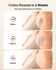 IPL Hair Removal Device Ice-Cooling 3 in 1 Painless 16J Photoepilator
