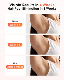 IPL Devices Hair Removal Laser 17J 999900 Light Pulses HR/SC/RA 9