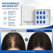 Microneedle Hair Regrowth Kit Solution Scalp Nourishing Serum For Hair