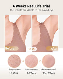 IPL Hair Removal with Ice Cooling Care Function for Women Men