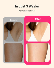 Laser Hair Removal 999999+ Fast flashes 3 In 1 IPL At Home Hair Remover