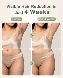 IPL Hair Removal with Ice Cooling Function for Women,Long-Lasting